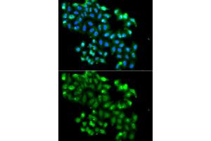 Immunofluorescence analysis of A549 cells using PHF11 antibody (ABIN5975729). (PHF11 抗体)