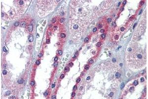 Immunohistochemistry (Formalin-fixed Paraffin-embedded Sections) (IHC (fp)) image for anti-Occludin (OCLN) (AA 35-84) antibody (ABIN768875)
