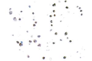 Immunocytochemistry (ICC) image for anti-Thymus High Mobility Group Box Protein (TOX) (AA 50-100) antibody (ABIN7453374) (Recombinant TOX 抗体  (AA 50-100))
