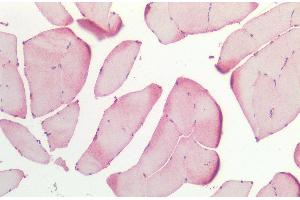 Immunohistochemistry analysis using Rabbit Anti-HSP27 Polyclonal Antibody (ABIN1027725 and ABIN1027726). (HSP27 抗体)