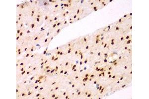Immunohistochemistry of paraffin-embedded Human colon using TEAD3 Polyclonal Antibody at dilution of 1:100 (40x lens). (TEAD3 抗体)