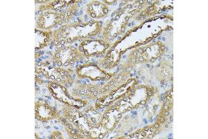 Immunohistochemistry of paraffin-embedded rat kidney using D antibody (ABIN7266712) at dilution of 1:100 (40x lens). (DAPK3 抗体  (AA 1-100))