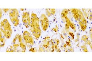 Immunohistochemistry of paraffin-embedded Human stomach using PRKCE Polyclonal Antibody at dilution of 1:100 (40x lens). (PKC epsilon 抗体)
