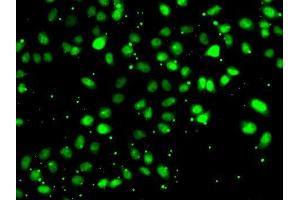 Immunofluorescence analysis of HeLa cells using NUDT2 antibody. (NUDT2 抗体  (AA 1-147))