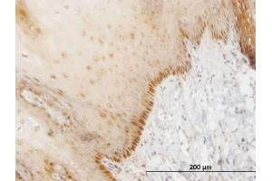 Immunoperoxidase of monoclonal antibody to HOXB7 on formalin-fixed paraffin-embedded human esophagus. (HOXB7 抗体  (AA 55-120))