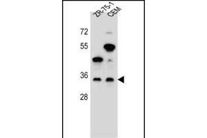 GB Antibody (N-term) (ABIN655821 and ABIN2845245) western blot analysis in ZR-75-1,CEM cell line lysates (35 μg/lane). (GPM6B 抗体  (N-Term))