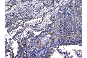 IHC analysis of GSTM3 using anti-GSTM3 antibody . (GSTM3 抗体  (AA 93-206))