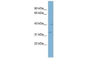Myozenin 1 antibody used at 1 ug/ml to detect target protein. (Myozenin 1 抗体  (Middle Region))