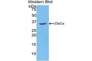 Western blot analysis of the recombinant protein. (PIM2 抗体  (AA 34-292))