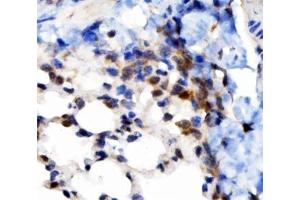 IHC analysis of VAPB using anti-VAPB antibody (ABIN5693292). (VAPB 抗体  (AA 2-55))
