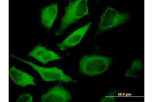 Immunofluorescence (IF) image for anti-ATPase, H+ Transporting, Lysosomal 70kDa, V1 Subunit A (ATP6V1A) (AA 508-617) antibody (ABIN513626)