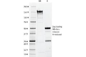SDS-PAGE Analysis Purified EpCAM Mouse Monoclonal Antibody (EGP40/1110).