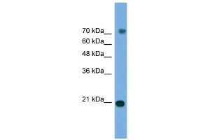 WB Suggested Anti-MAPK6 Antibody Titration: 0. (MAPK6 抗体  (Middle Region))