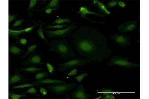Immunofluorescence of monoclonal antibody to MTMR3 on HeLa cell. (MTMR3 抗体  (AA 579-674))
