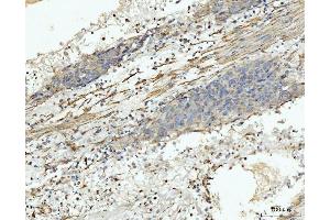 IHC analysis of MT-ND5 using anti-MT-ND5 antibody (ABIN7600145).