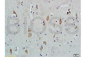 Formalin-fixed and paraffin embedded rat brain tissue labeled with Rabbit Anti-NGF-beta Polyclonal Antibody (ABIN724430) at 1:200 followed by conjugation to the secondary antibody and DAB staining. (NGFB 抗体  (AA 151-220))