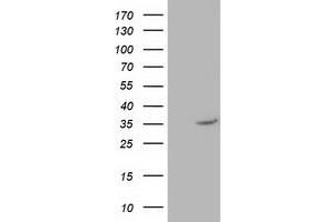 Western Blotting (WB) image for anti-Nudix (Nucleoside Diphosphate Linked Moiety X)-Type Motif 6 (NUDT6) antibody (ABIN1499868) (NUDT6 抗体)