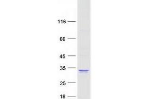 Validation with Western Blot