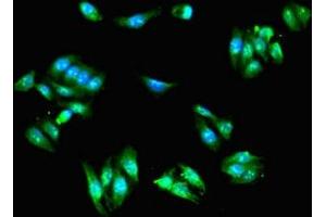 Immunofluorescent analysis of HepG2 cells using ABIN7143550 at dilution of 1:100 and Alexa Fluor 488-congugated AffiniPure Goat Anti-Rabbit IgG(H+L) (Scinderin 抗体  (AA 556-703))
