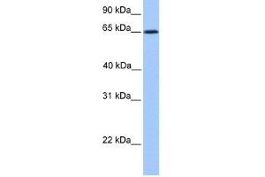 WB Suggested Anti-ZNF837 Antibody Titration:  0. (ZNF837 抗体  (N-Term))