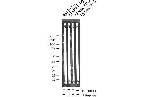 Western blot analysis of Phospho-PDCD4 (Ser67) expression in various lysates (PDCD4 抗体  (pSer67))