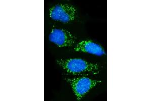 IF analysis of Pyrin/MEFV using anti-Pyrin/MEFV antibody (ABIN7601809). (MEFV 抗体  (AA 463-781))