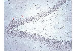 Immunohistochemistry (IHC) image for anti-Serotonin Receptor 2B (HTR2B) (AA 1-58) antibody (ABIN967504) (Serotonin Receptor 2B 抗体  (AA 1-58))