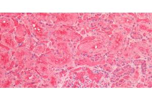 Immunohistochemistry (Paraffin-embedded Sections) (IHC (p)) image for anti-Enolase 1 (ENO1) antibody (ABIN7236386)