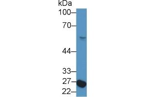 Detection of NFIX in Rat Serum using Polyclonal Antibody to Nuclear Factor I/X (NFIX) (NFIX 抗体  (AA 13-298))