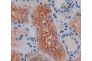 Used in DAB staining on fromalin fixed paraffin- embedded Kidney tissue (SLFN5 抗体  (AA 658-891))