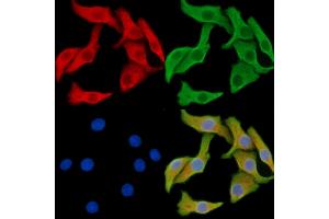 ABIN7095344 and ABIN7099401 staining Hela cells by IF/ICC.