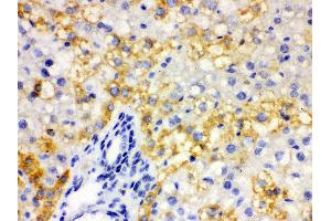Anti- ALDH2 Picoband antibody, IHC(P) IHC(P): Rat Liver Tissue (ALDH2 抗体  (N-Term))