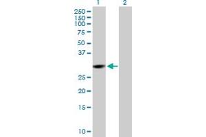 Western Blot analysis of CMBL expression in transfected 293T cell line by CMBL MaxPab polyclonal antibody. (CMBL 抗体  (AA 1-245))
