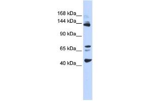 WB Suggested Anti-BRD8 Antibody Titration:  0. (BRD8 抗体  (Middle Region))