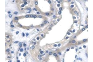Detection of β-catenin in Human Kidney Tissue using Polyclonal Antibody to Beta Catenin (β-catenin)