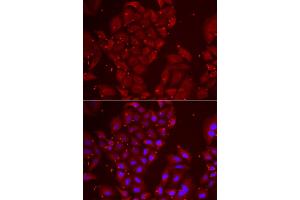 Immunofluorescence analysis of U2OS cells using TPP2 antibody. (Tpp2 抗体)