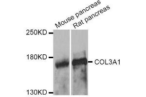 Western blot analysis of extracts of various cell lines, using COL3A1 antibody. (COL3A1 抗体  (AA 1217-1466))
