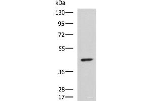 Western blot analysis of Hela cell lysate using ARPC1B Polyclonal Antibody at dilution of 1:1000 (ARPC1B 抗体)