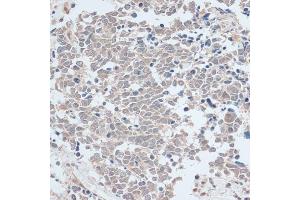 Immunohistochemistry (IHC) image for anti-Zinc Finger Protein 581 (ZNF581) (AA 1-90) antibody (ABIN6150520)
