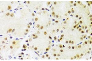 Immunohistochemistry of paraffin-embedded Human stomach using PRPF3 Polyclonal Antibody at dilution of 1:100 (40x lens). (PRPF3 抗体)
