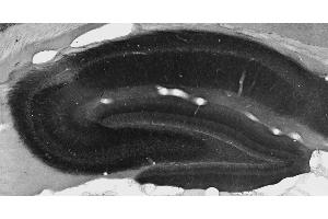 Adult rat hippocampal immunohistochemistry. (KCNT2 抗体  (AA 564-624))