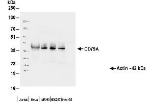 Immunoprecipitation (IP) image for anti-B-cell antigen receptor complex-associated protein alpha chain (CD79A) (AA 33-143) antibody (ABIN7453962)