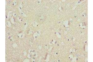Immunohistochemistry of paraffin-embedded human brain tissue using ABIN7145497 at dilution of 1:100 (GLB1L2 抗体  (AA 401-636))