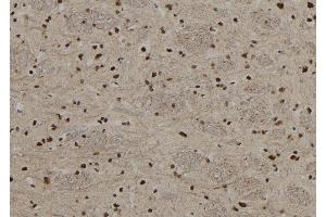 ABIN6267208 at 1/100 staining Rat brain tissue by IHC-P. (MECP2 抗体  (pSer80))