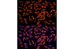 Immunofluorescence (IF) image for anti-Epidermal Growth Factor Receptor Pathway Substrate 15 (EPS15) (AA 660-840) antibody (ABIN6140236)