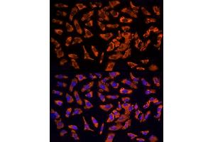Immunofluorescence analysis of U2OS cells using EPS15 Rabbit pAb  at dilution of 1:200 (40x lens). (EPS15 抗体  (AA 660-840))