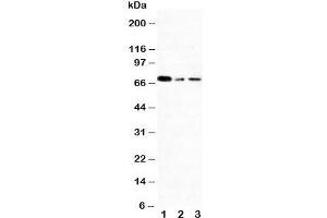 Western blot testing of XRCC1 antibody and Lane 1:  293T;  2: A431;  3: HeLa cell lysate.