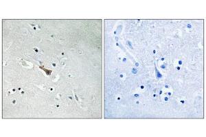 Immunohistochemistry analysis of paraffin-embedded human brain tissue using APLP2 (Phospho-Tyr755) antibody. (APLP2 抗体  (pTyr755))