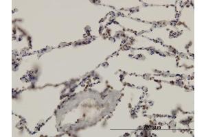 Immunostaining (ISt) image for anti-Aryl Hydrocarbon Receptor Nuclear Translocator (ARNT) (AA 1-110) antibody (ABIN559953)