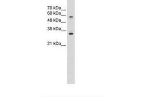 Image no. 2 for anti-Solute Carrier Family 22 (Organic Cation Transporter), Member 1 (SLC22A1) (C-Term) antibody (ABIN203397) (SLC22A1 抗体  (C-Term))